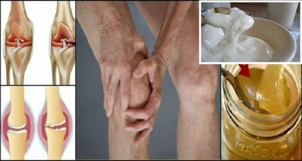 remedii pentru durerile de spate și articulații